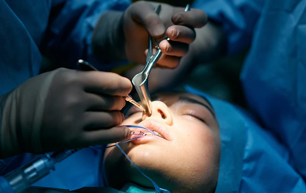 Paquete Rinoplastia